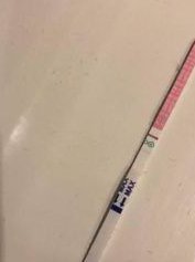 女性小肚子经常胀气爱放屁是什么情况？